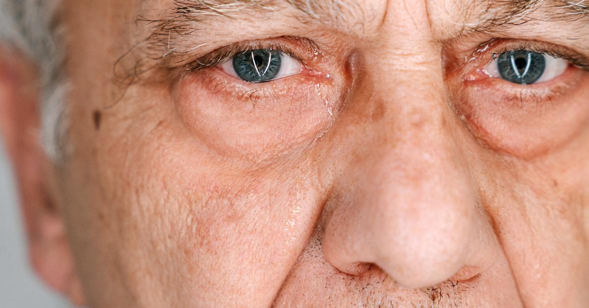 Hombre con los ojos llorosos