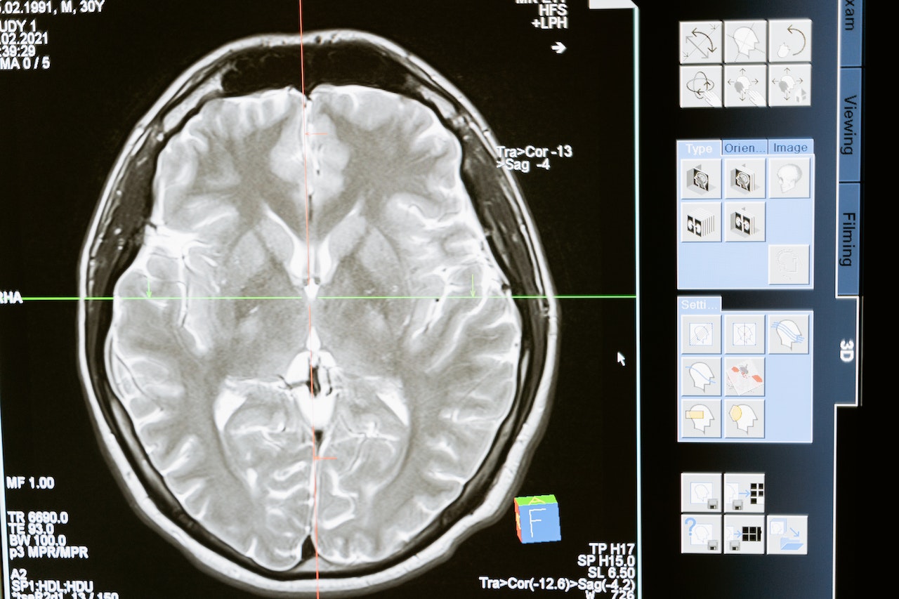 Escáner cerebral